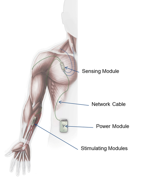 Example of how SCI works